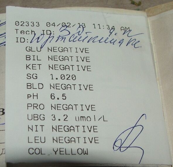 Nire gernuaren analisiaren emaitzak fememalaren aurretik